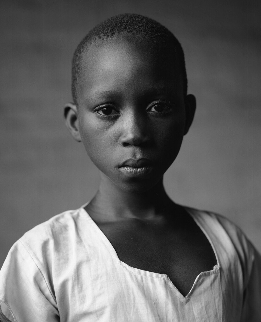 A young child dressed in a white top stares at the camera.
